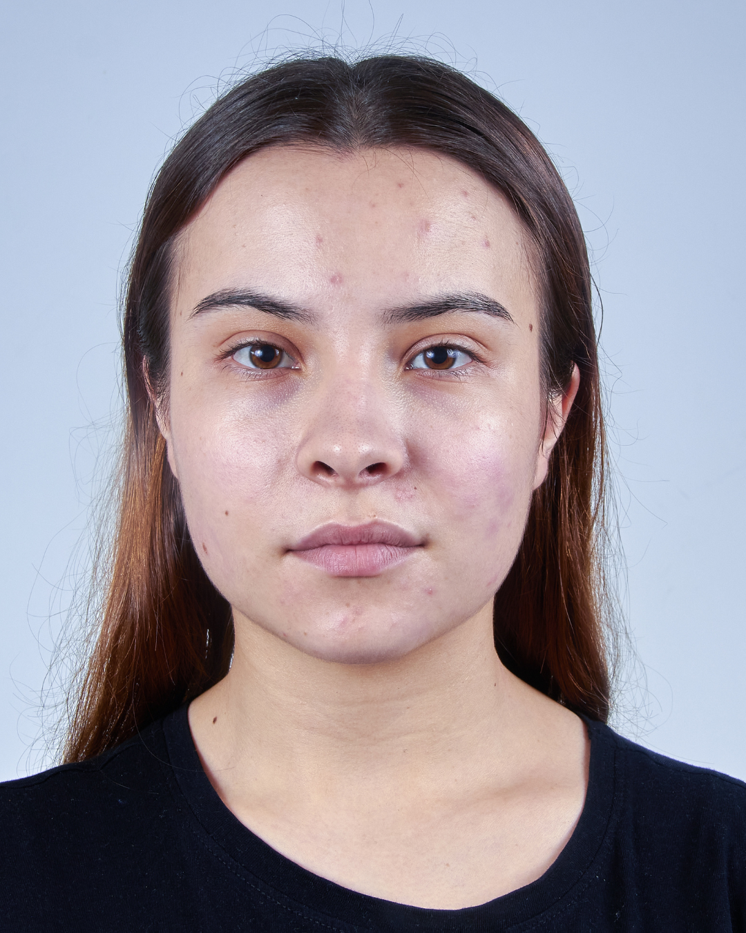 Unreine & ölige Haut Bundle