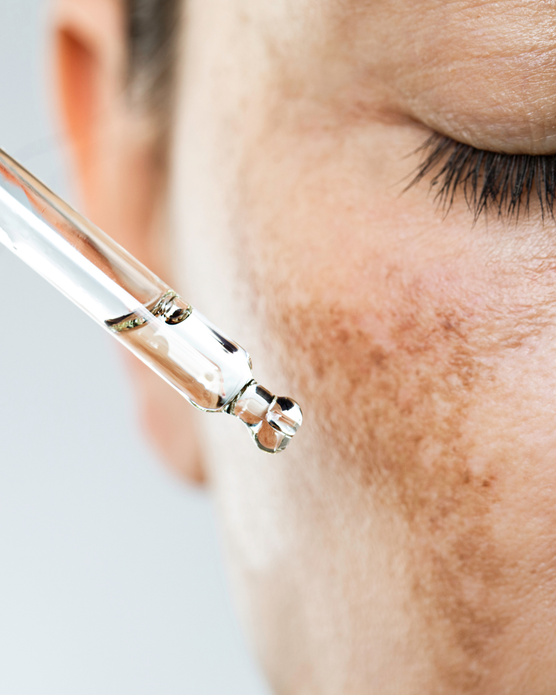 Hyperpigmentierung-Bundle - gegen Hyperpigmentierungen